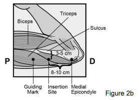 Implanon Dosage Figure 2b