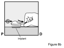 Implanon Dosage Figure 8b