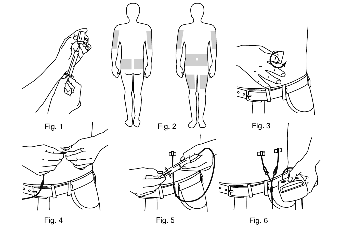 Gamunex-C Dosage Figures 1-6