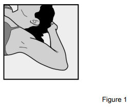 Implanon Dosage Figure 1