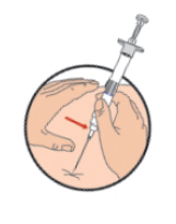 Lucrin Dosage Image 5