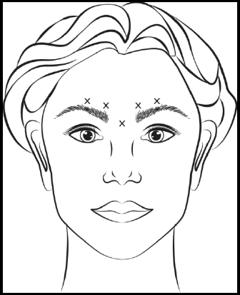 Botox Dosage Image 2