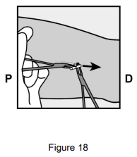 Implanon Dosage Figure 18