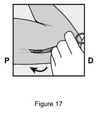 Implanon Dosage Figure 17