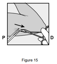 Implanon Dosage Figure 15