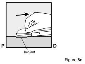 Implanon Dosage Figure 8c