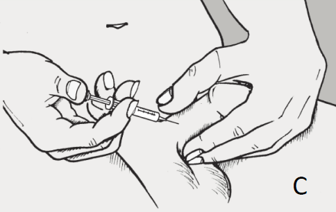 Caverject Dosage Image 10