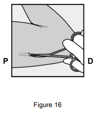 Implanon Dosage Figure 16