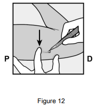 Implanon Dosage Figure 12
