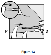 Implanon Dosage Figure 13