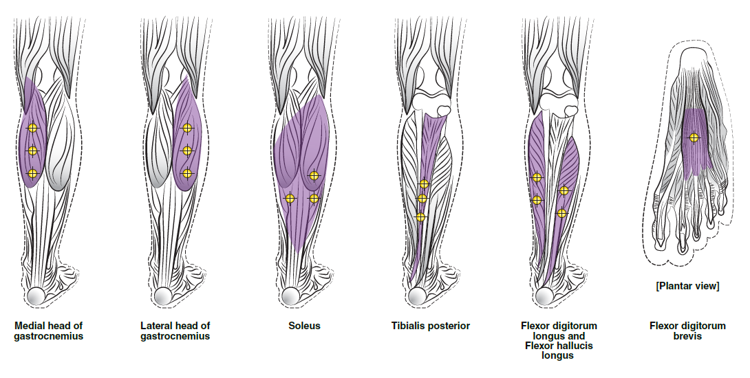 Botox Dosage Image 1